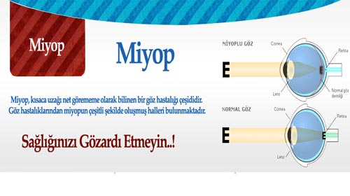 miyop