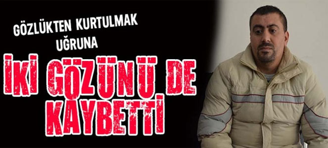 mansetgozoperasyon