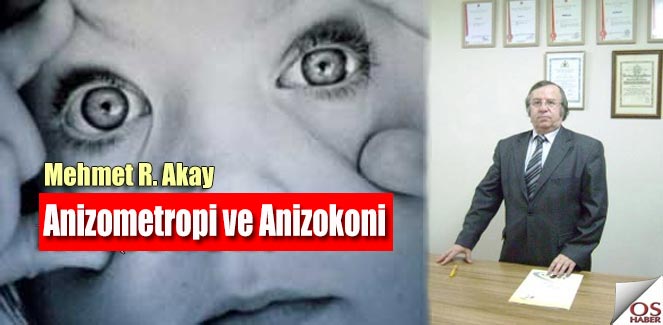 AnizometropiAnizokoni