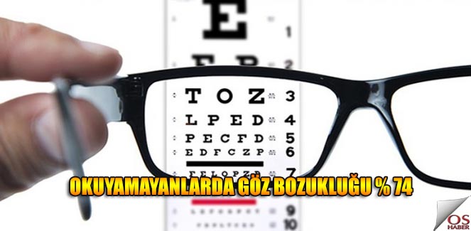 gozbozuklugu