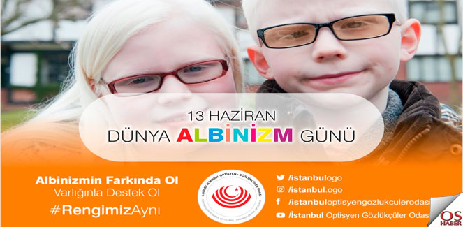 albinizm