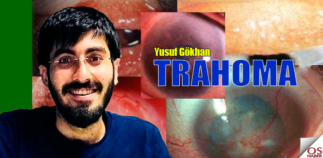 trahomayusufgokhan