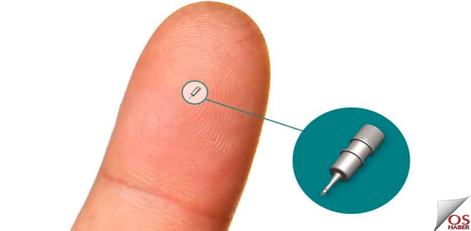 implant